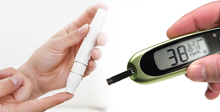 Glucose test
